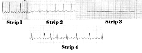 Cardiovascular System Circulatory Disorders NCLEX Questions with Rationale 5