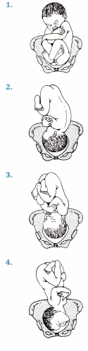 Birth Experience NCLEX Questions with Rationale 1