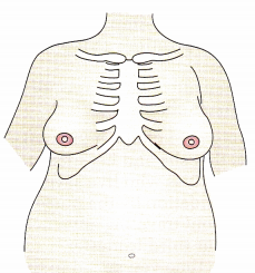 Antepartum Care NCLEX Questions with Rationale 5