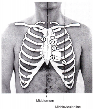 Cardiac Health Problems NCLEX Questions with Rationale 6