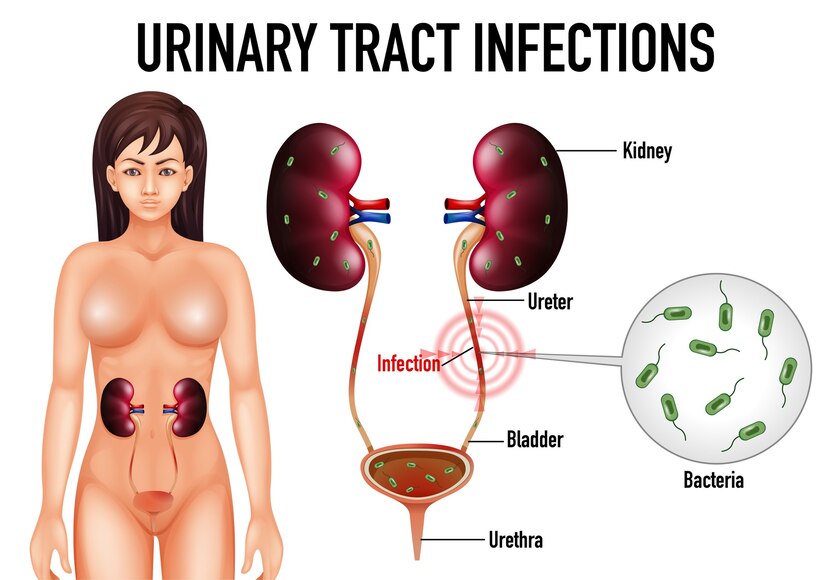 diuretics