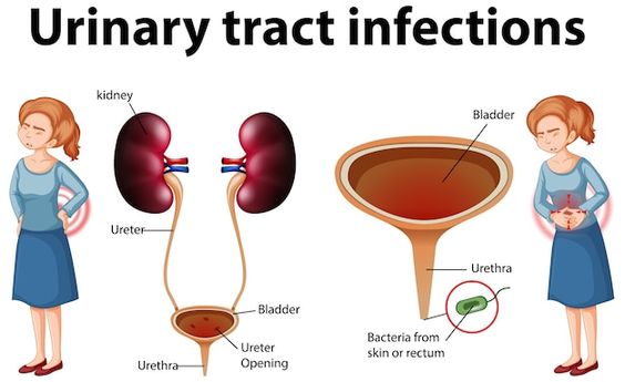 Renal NCLEX Questions With Rationale - Soumyahospitals.com