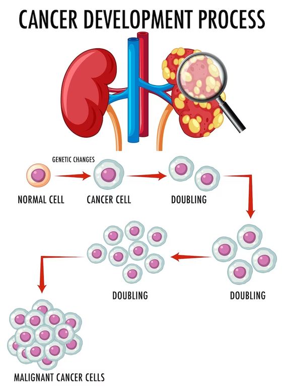 colorectal cancer