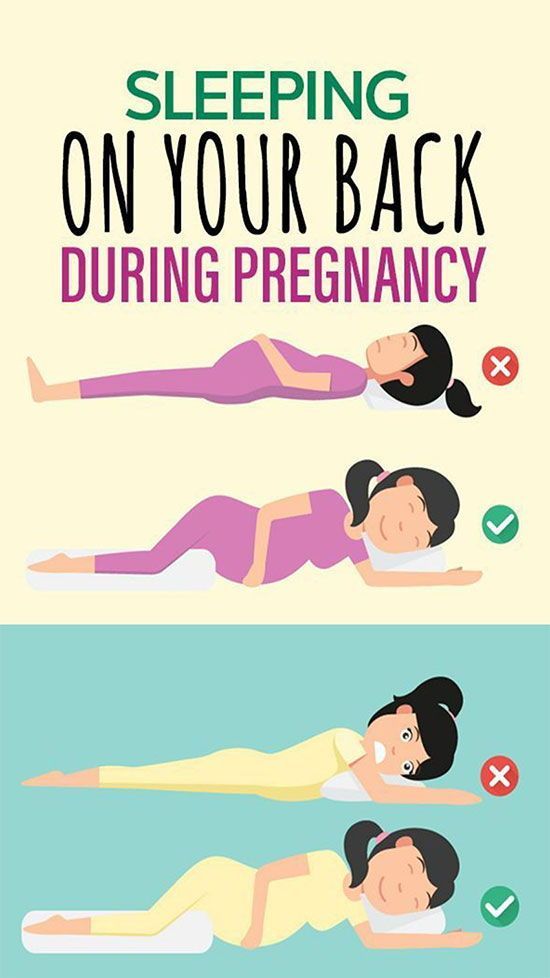 Complications of Pregnancy sleep