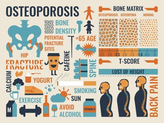 Osteoarthritis