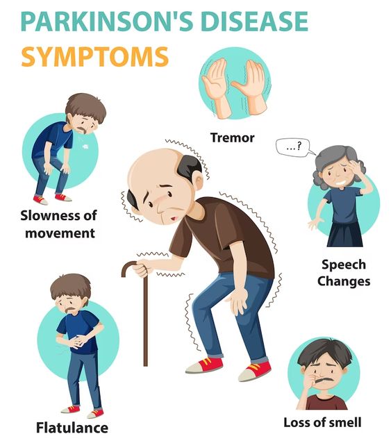 Parkinson’s disease