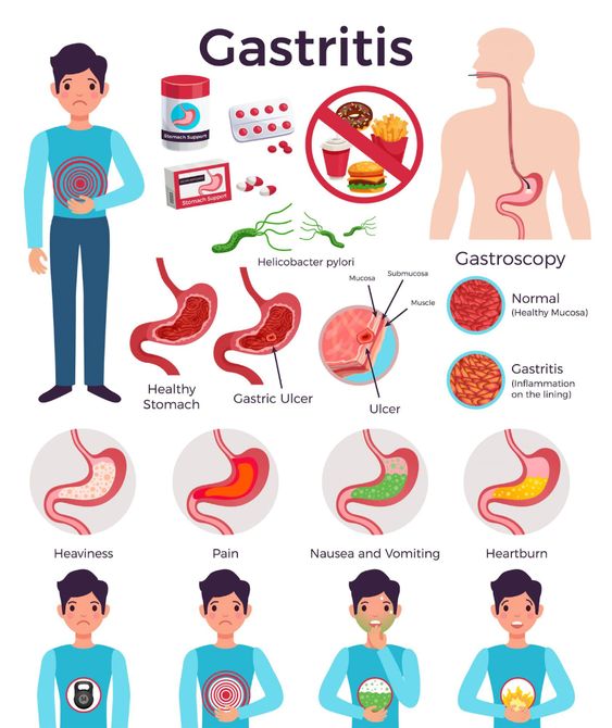 Upper Gastrointestinal Tract