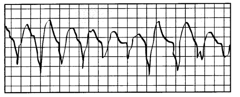 NCLEX RN Practice Test 3 with Rationale 4