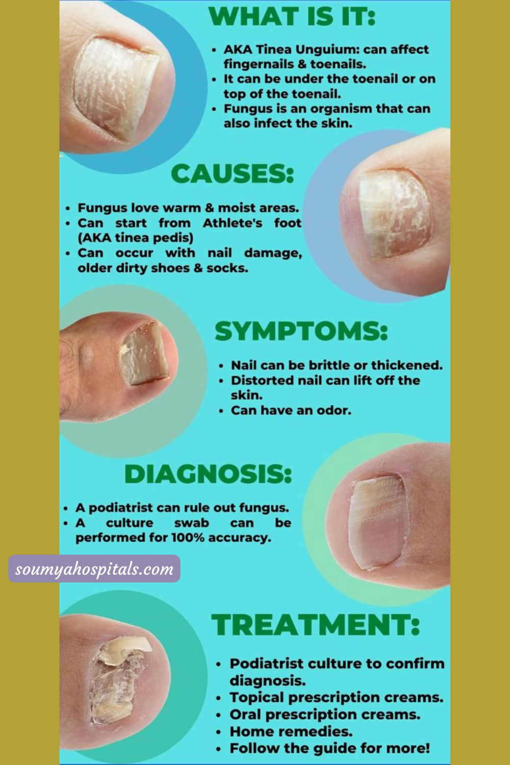 Top 3 Science-Backed Health Benefits Of Coconut Oil For Nails ...