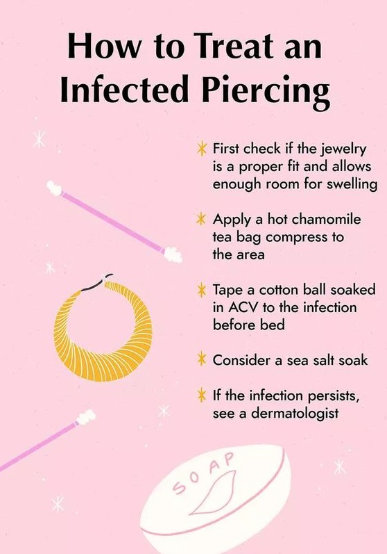 How To Get Rid Of Nose Piercing Bump Home Remedies That Work 