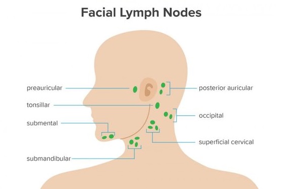 10 Home Remedies To Treat Swollen Lymph Nodes Naturally ...