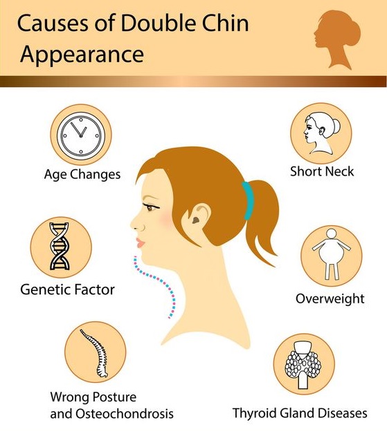 5-health-problems-that-may-cause-double-chin-soumyahospitals