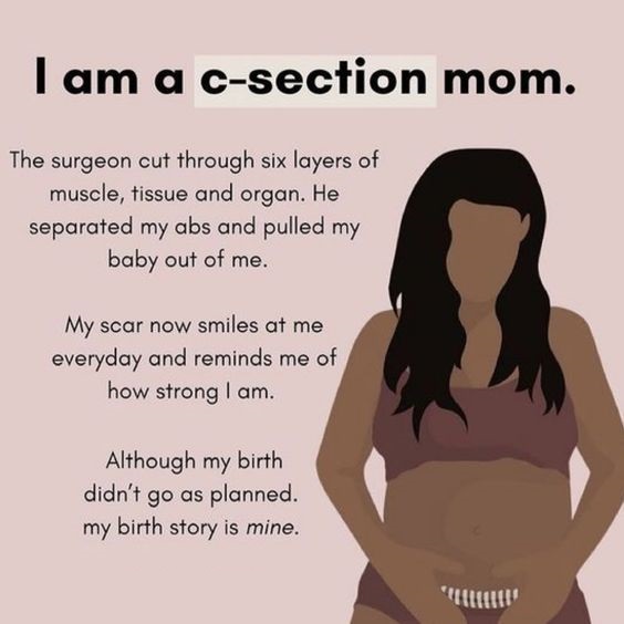 Caesarean Awareness