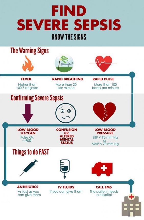 Severe Sepsis Requires Emergency Treatment