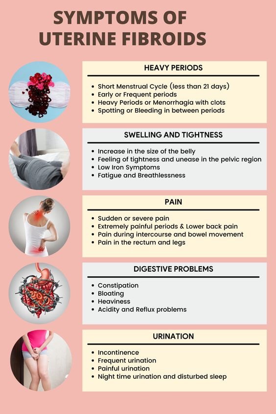 Extremely Painful Symptoms of Uterine Fibroids