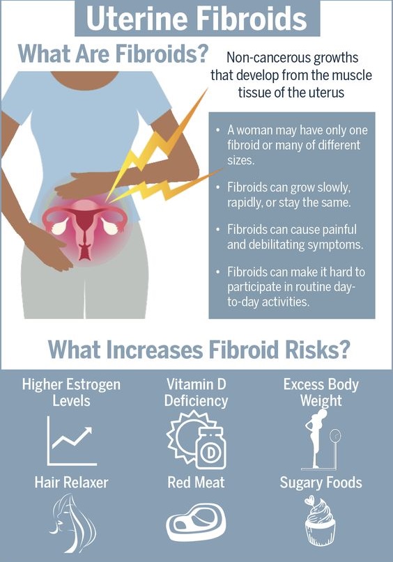 7 Tips For Treating Fibroids The Natural Way - soumyahospitals.com