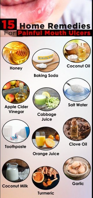 How To Get Rid Of Mouth Ulcers