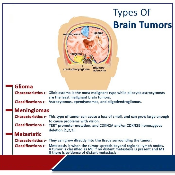 Types of Brain Tumors