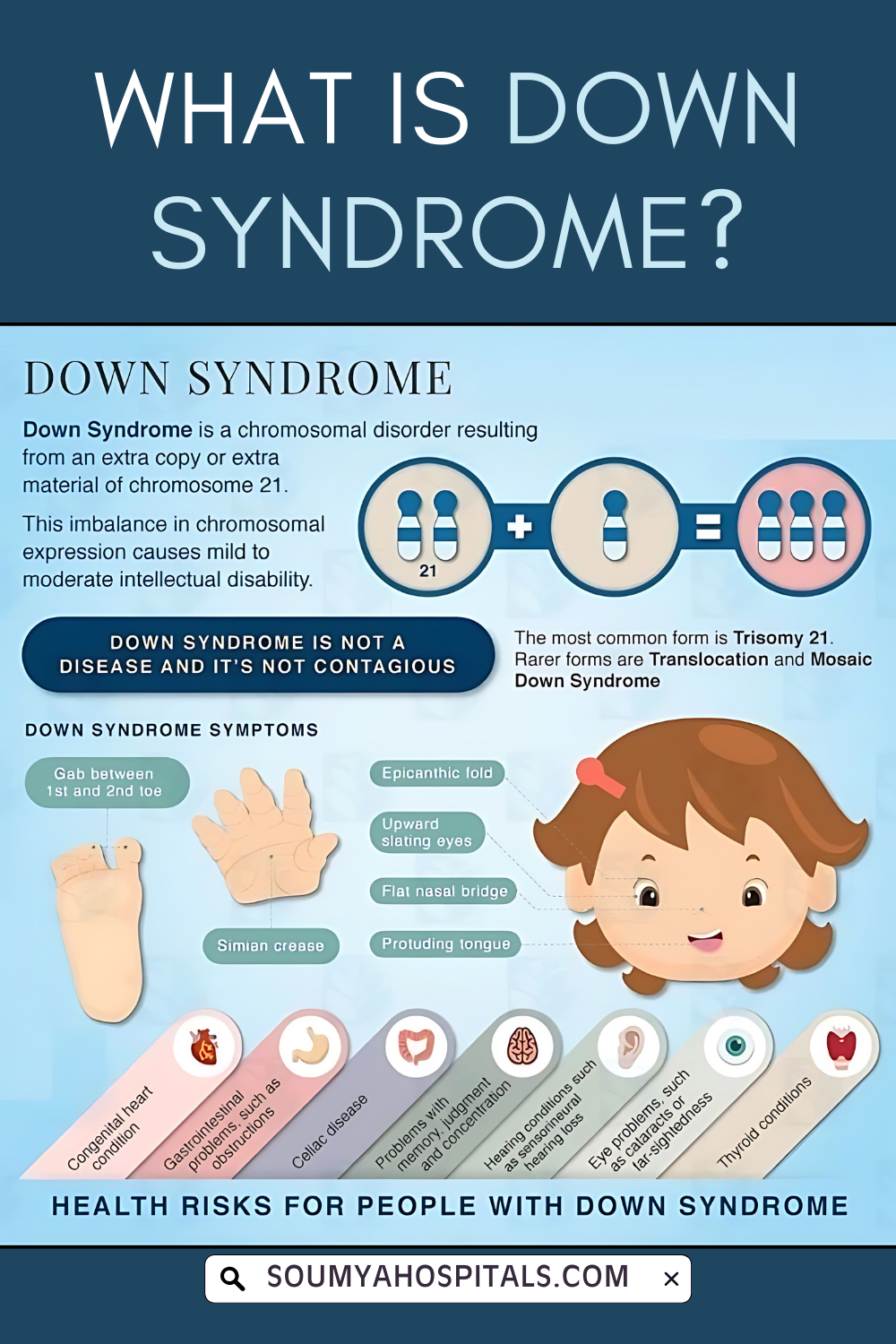 What Is Down Syndrome