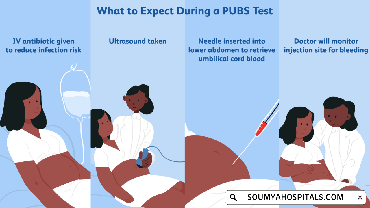 Purpose of Percutaneous Umbilical Blood Sampling (PUBS)