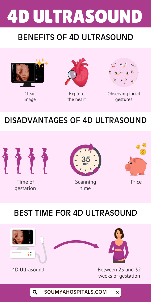 What is 4D Ultrasound