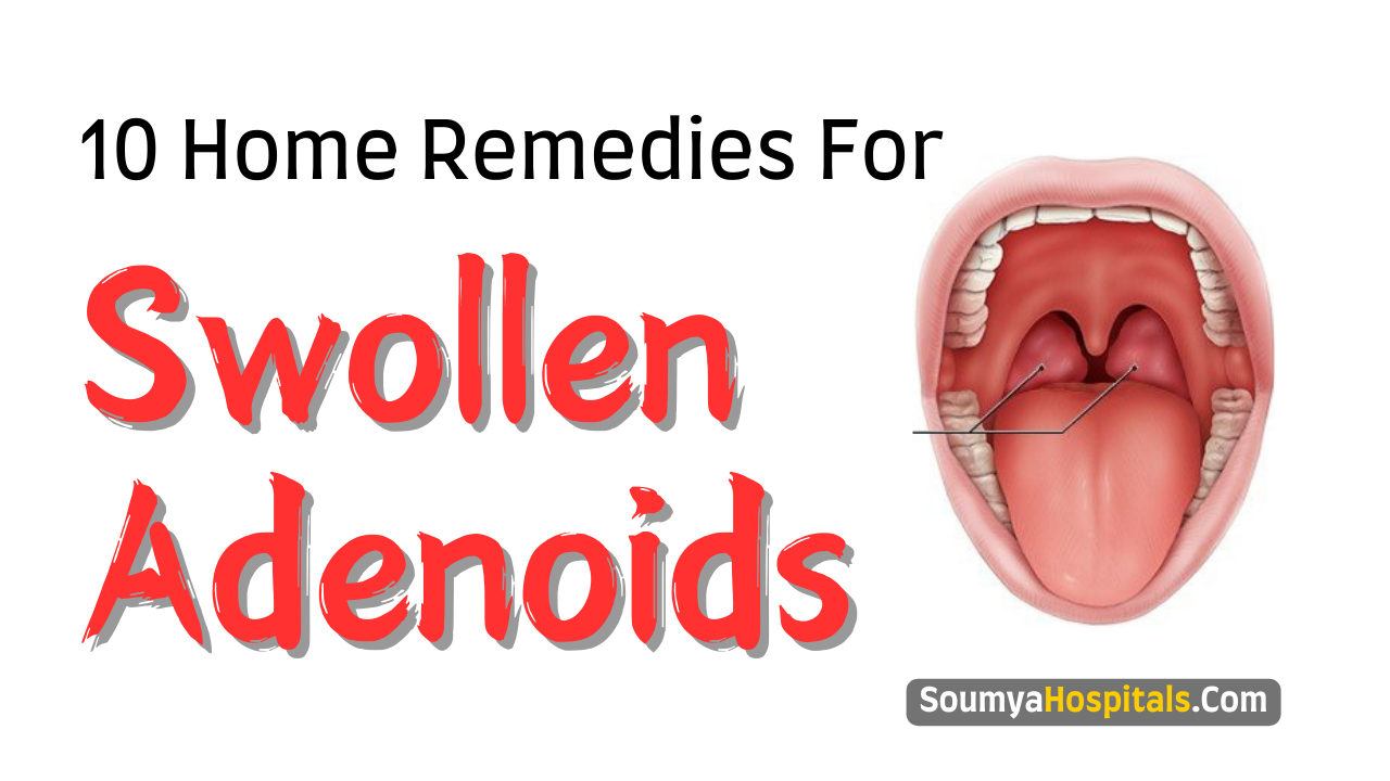 10_Home_Remedies_To_Tackle_Swollen_Adenoids_Naturally