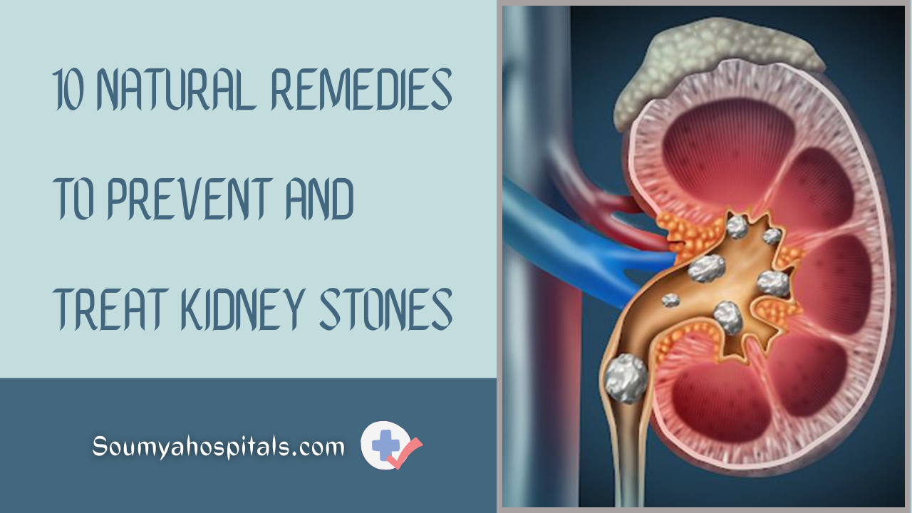 10-natural-remedies-to-prevent-and-treat-kidney-stones