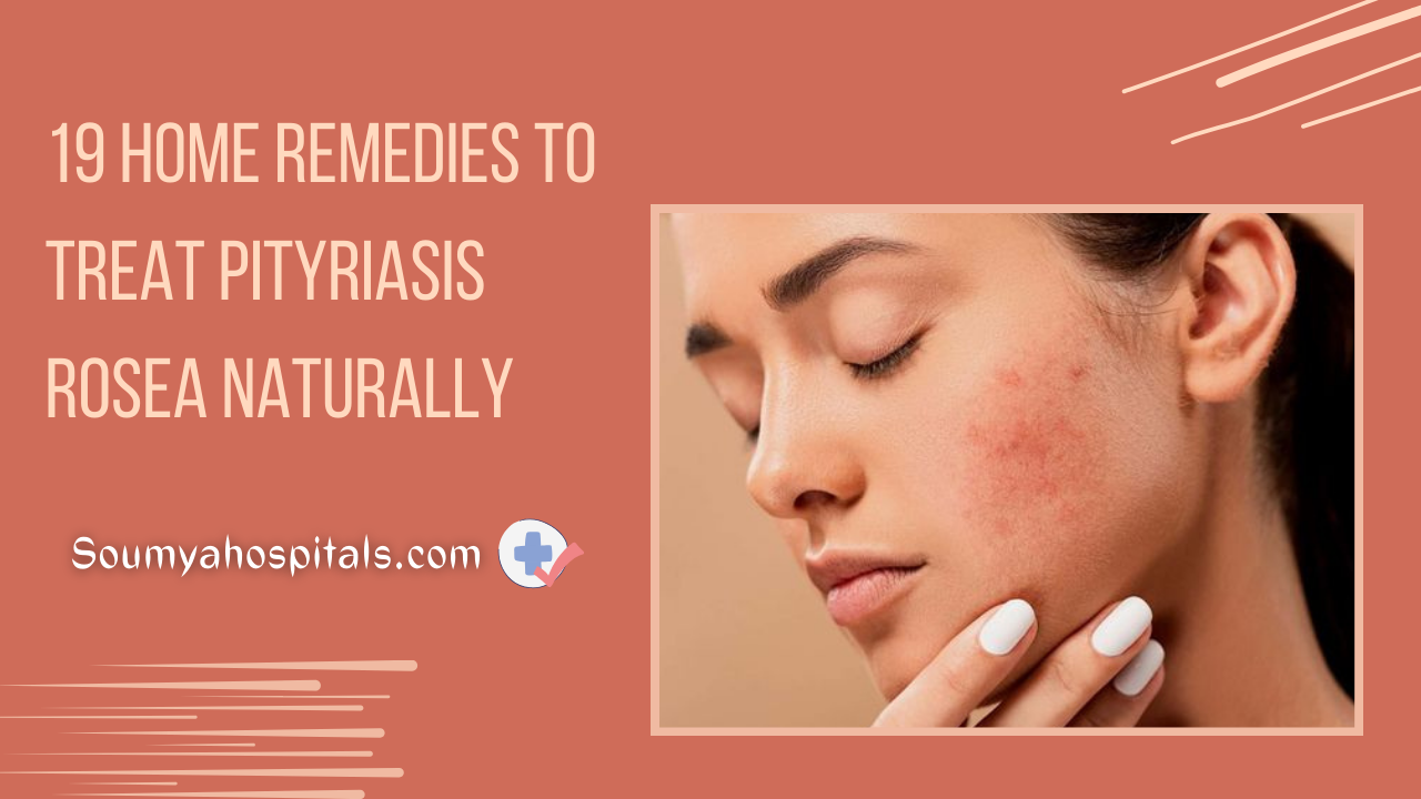 How To Get Rid Of Pityriasis Rosea Fast 19 Home Remedies To Treat Pityriasis Rosea Naturally - soumyahospitals.com