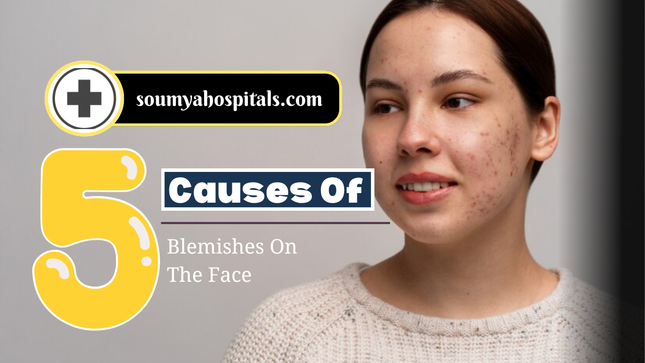 5 Causes Of Blemishes On The Face - soumyahospitals.com