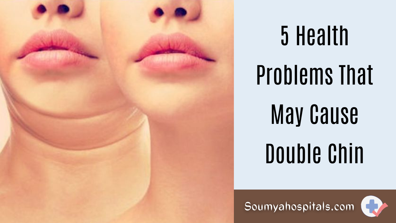 5-health-problems-that-may-cause-double-chin-soumyahospitals