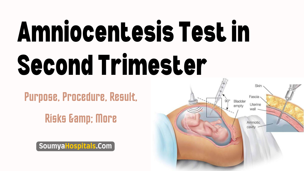 Amniocentesis Test in Second Trimester During Pregnancy