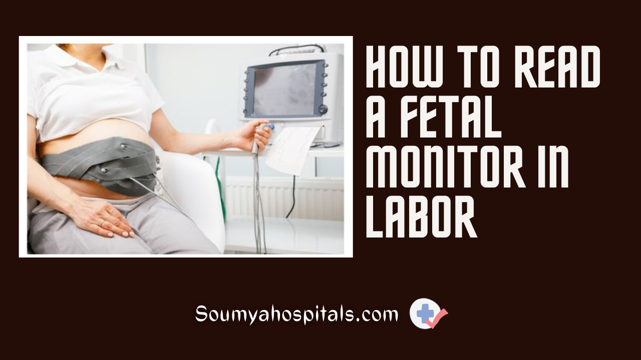 How To Read A Fetal Monitor In Labor