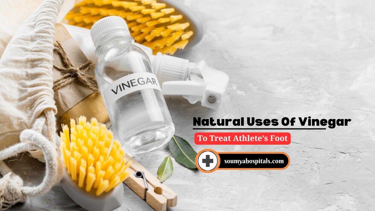 Natural Uses Of Vinegar To Treat Athlete’s Foot