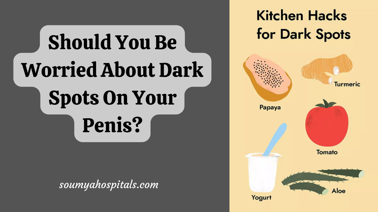 Should You Be Worried About Dark Spots On Your Penis?