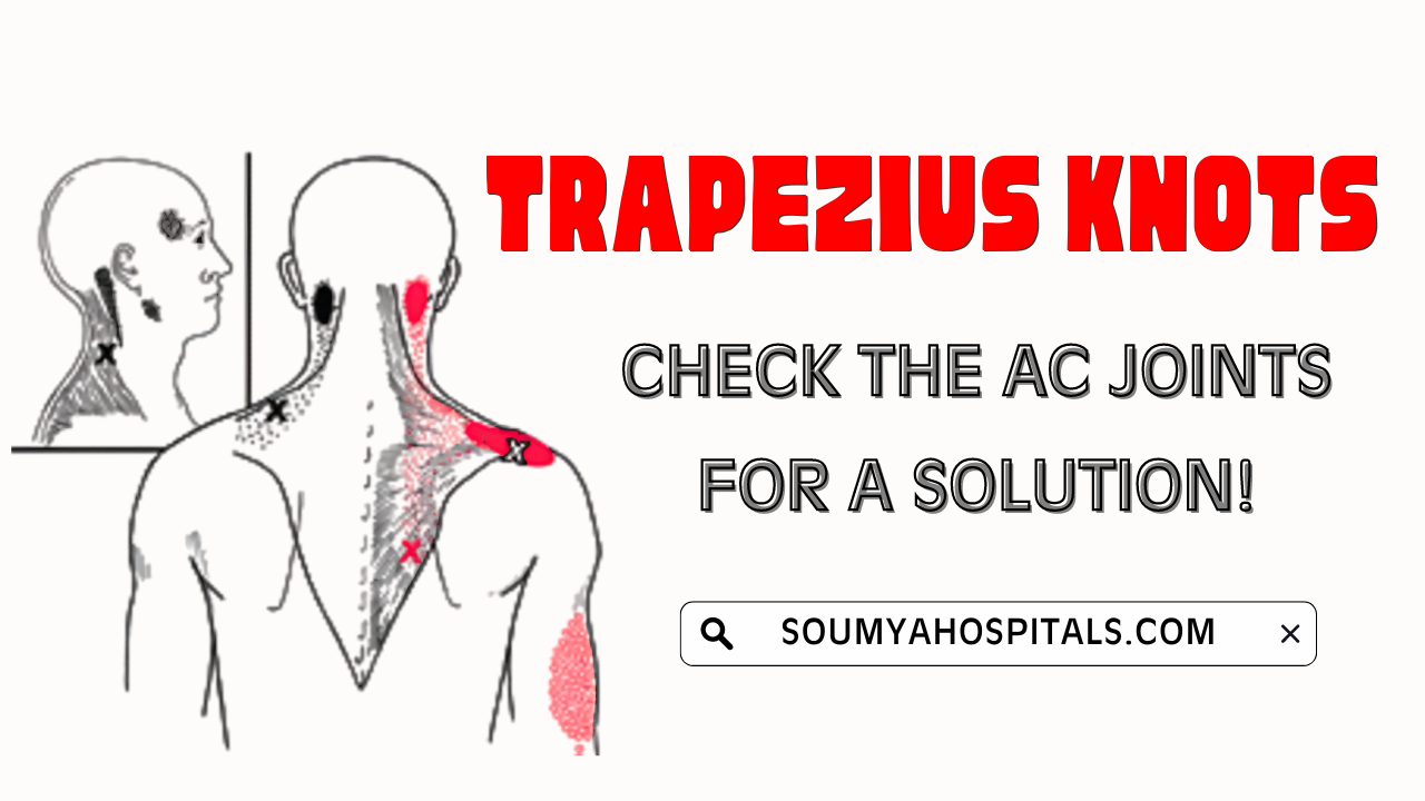 Trapezius_Knots_Check_The_AC_Joints_For_A_Solution